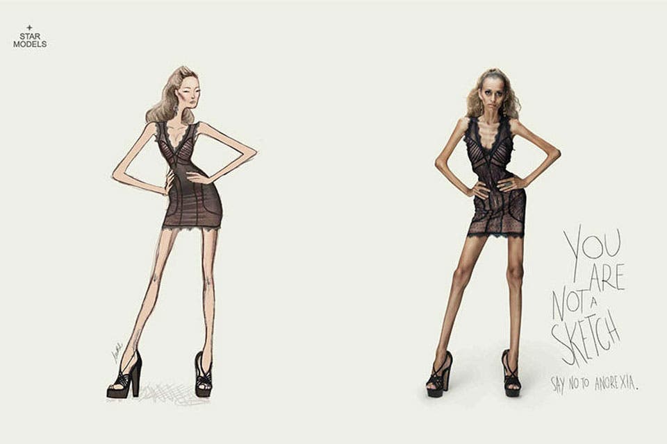 No eres un esquema, decile no a la anorexia