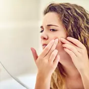 Vitamina B12 y acné: ¿cómo se relacionan?