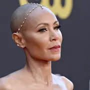 Jada Pinkett Smith fue una de las primeras celebrities en hablar sobre alopecia.