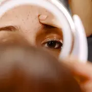 Cómo usar los parches para el acné.