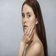 Manchas en la piel: qué tenés que saber para tratarlas.