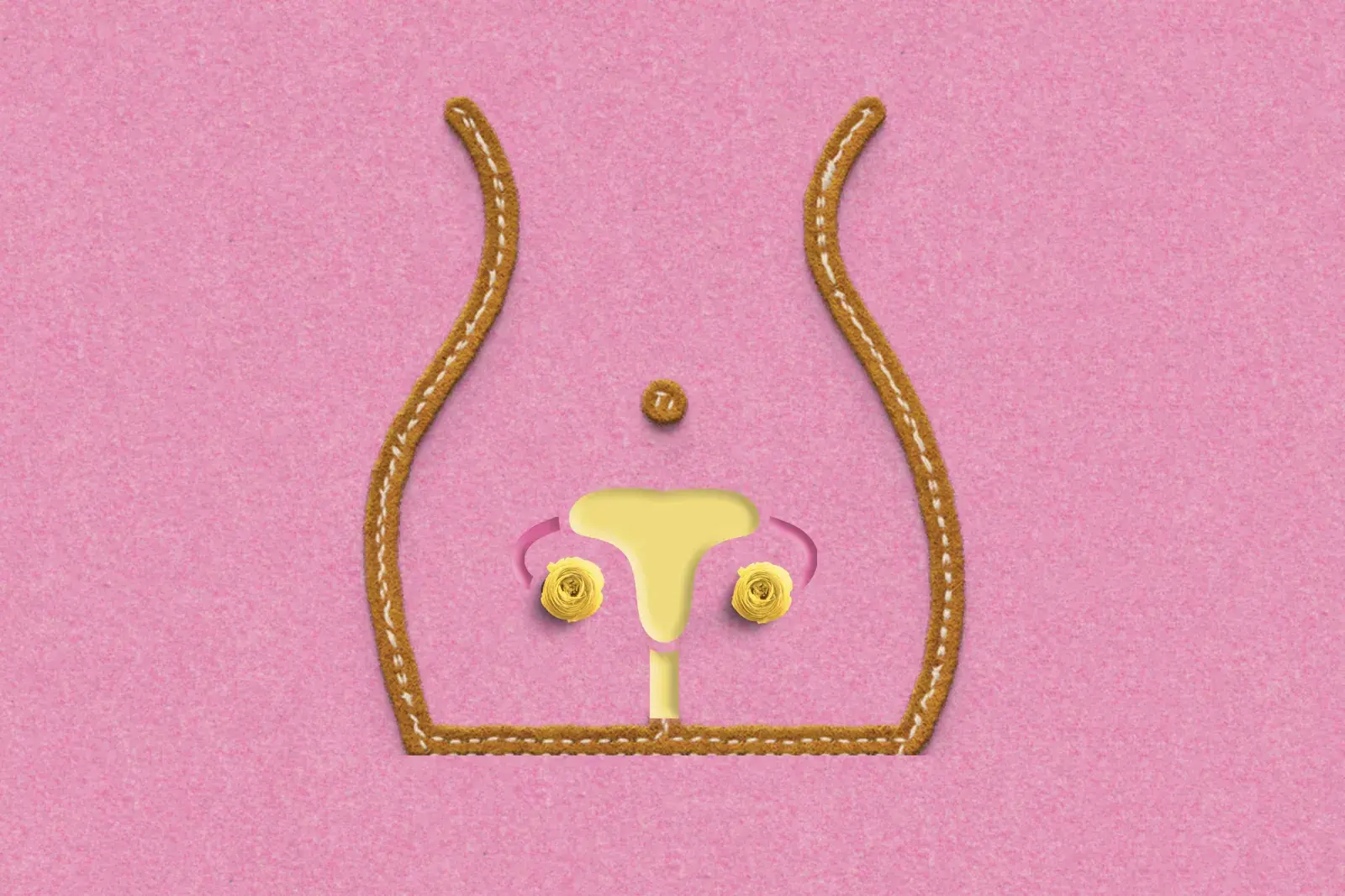 Ligadura de trompas: un método anticonceptivo rodeado de tabúes.