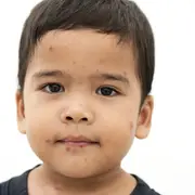 Sarampión: alerta de la OMS y la importancia de la vacunación.