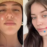 Parches anti acné: la tendencia que crece cada vez más en las redes sociales