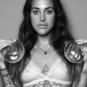 Enfermedad de implantes mamarios.