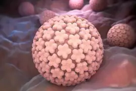 El HPV es responsable de más del 95% de casos de carcinoma de cérvix