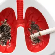 El cigarrillo es causante del cáncer de pulmón y de numerosas enfermedades respiratorias crónicas