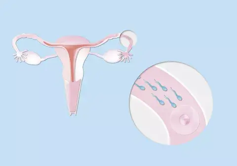 La vitrificación consiste en extraer óvulos cuando la mujer es joven como para tener en abundancia y calidad, congelarlos, mantenerlos el tiempo que sea necesario, y usarlos cuando desee un embarazo. La vitrificación consiste en extraer óvulos cuando la mujer es joven como para tener en abundancia y calidad, congelarlos, mantenerlos el tiempo que sea necesario, y usarlos cuando desee un embarazo.