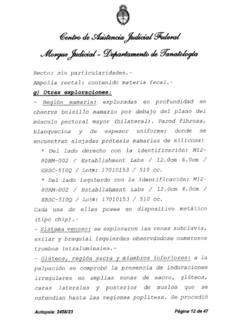 Informe de la autopsia de Silvina Luna.