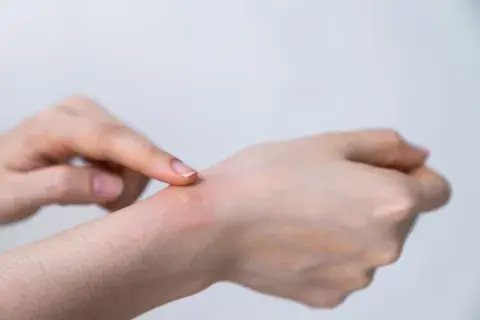 En Argentina hubo un pico histórico de casos de dengue. En Argentina hubo un pico histórico de casos de dengue.