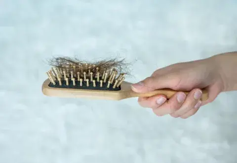 Un cepillo lleno de pelos debido a la caída del cabello Un cepillo lleno de pelos debido a la caída del cabello
