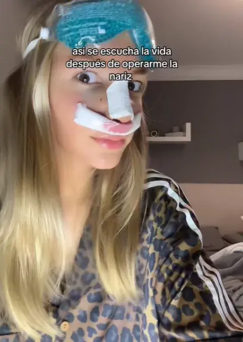 ¿Cuál fue la operación estética que se realizó Jazmín Oltra?