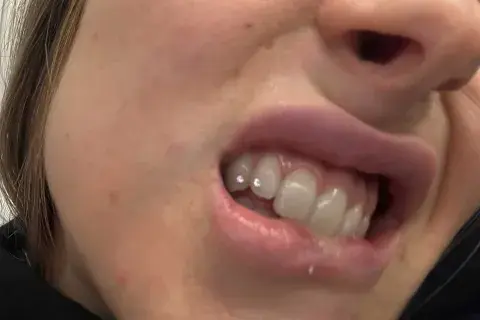Ámbar De Benedictis se sumó a la tendencia de los tooth gems Ámbar De Benedictis se sumó a la tendencia de los tooth gems
