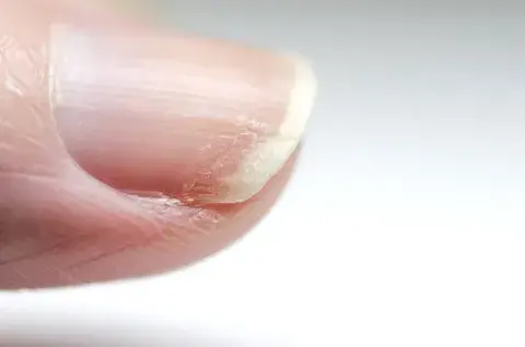 Los mejores sérums fortalecedores de uñas para tenerlas naturales sin roturas ni grietas