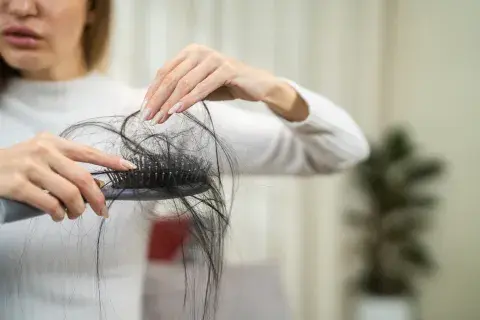 caida_del_pelo_1.jpg caida_del_pelo_1.jpg