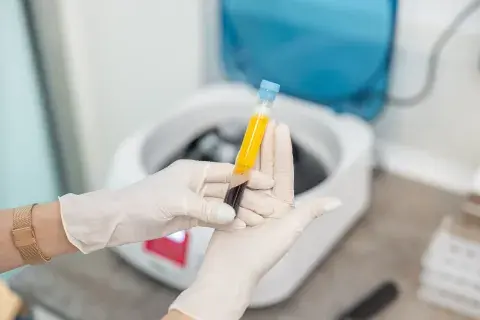 Plasma rico en plaquetas: el tratamiento que regenera la piel y fortalece el cabello desde adentro