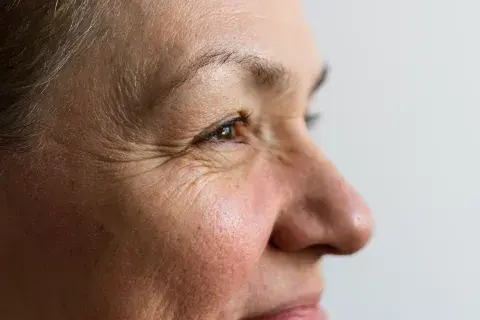 Una mujer sonriendo con lineas de expresión- mayor