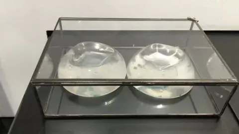 Una mujer donó los implantes de silicona que se puso años atrás a petición de su pareja