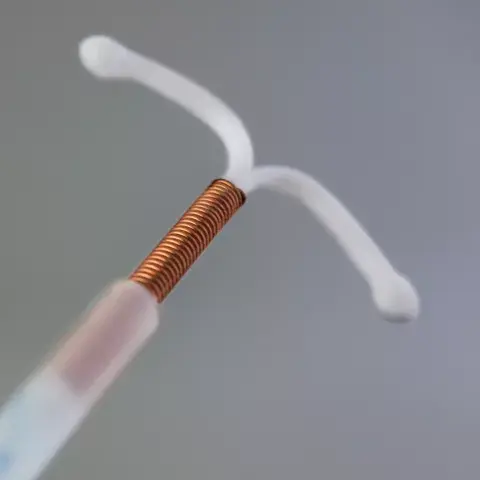 Dispositivo intrauterino, DIU de cobre. Dispositivo intrauterino, DIU de cobre.