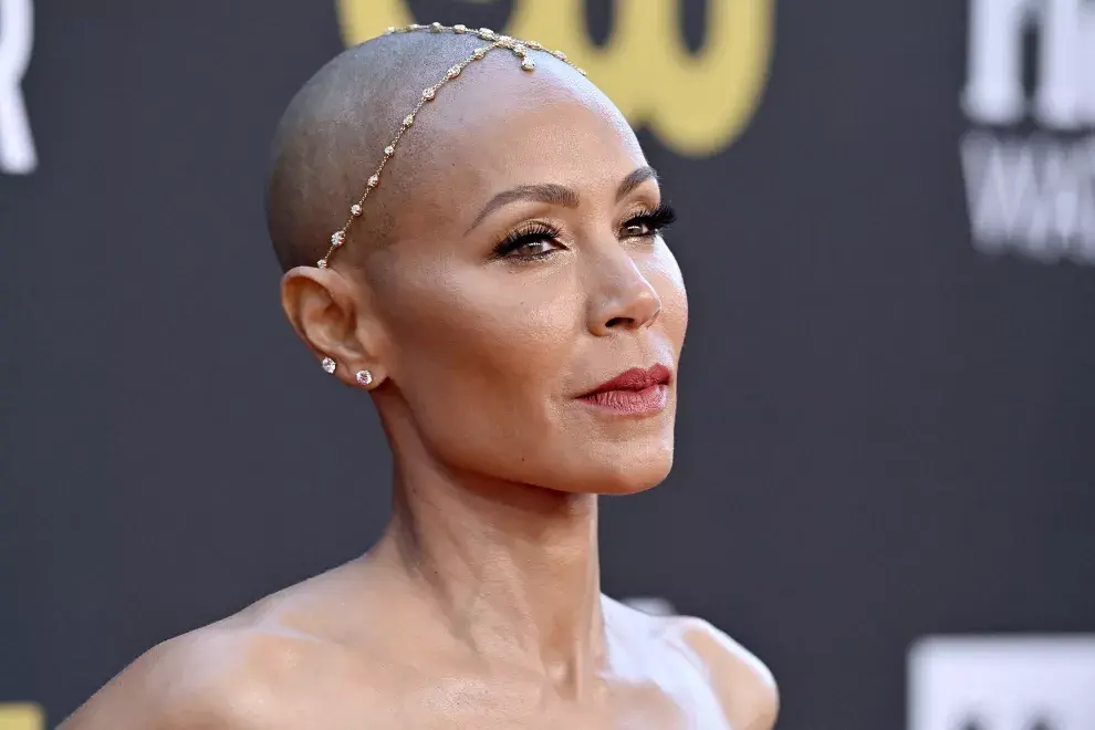 Jada Pinkett Smith fue una de las primeras celebrities en hablar sobre alopecia.