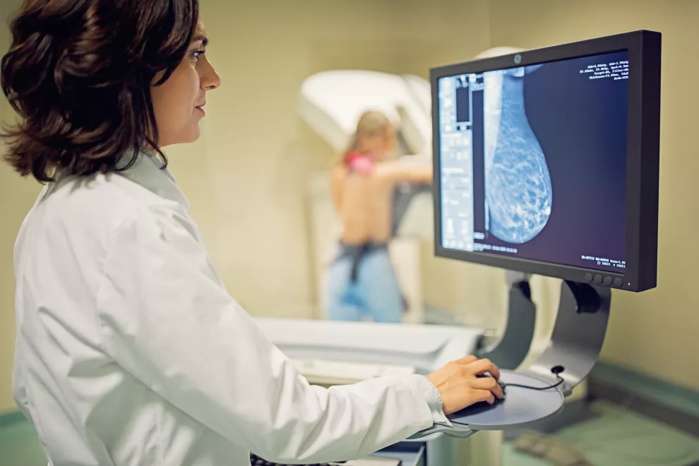 Mamografía: en qué consiste el estudio y por qué es tan importante