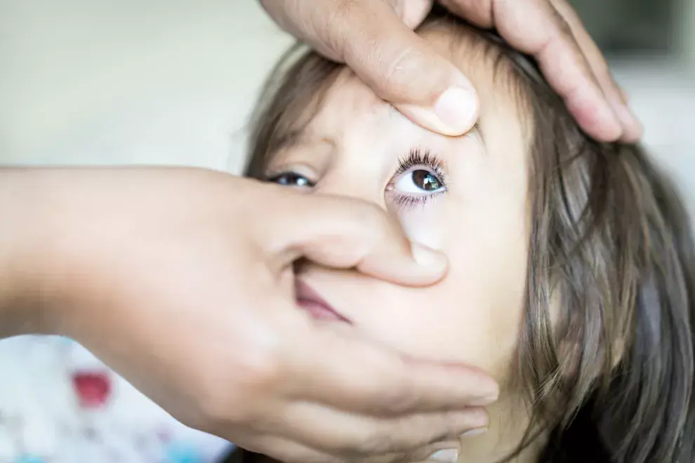 Conjuntivitis en niños: ¿cómo curarla y cuánto dura?