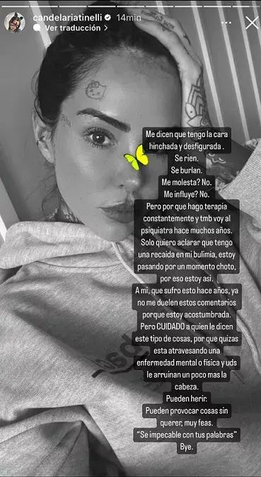 Cande Tinelli contó que sufrió una recaída en la bulimia. 