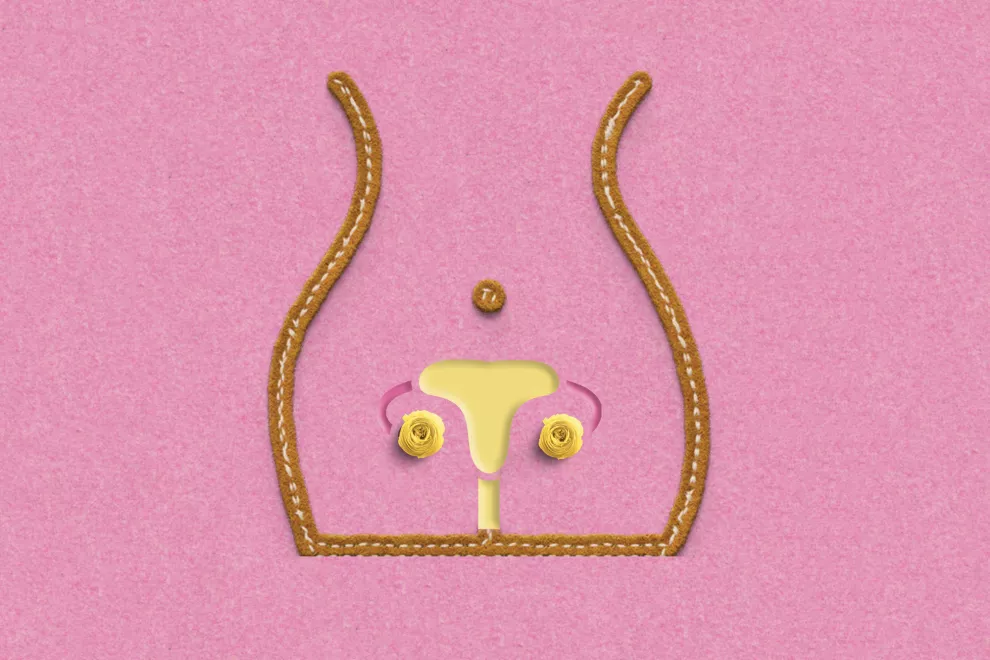 Ligadura de trompas: un método anticonceptivo rodeado de tabúes.