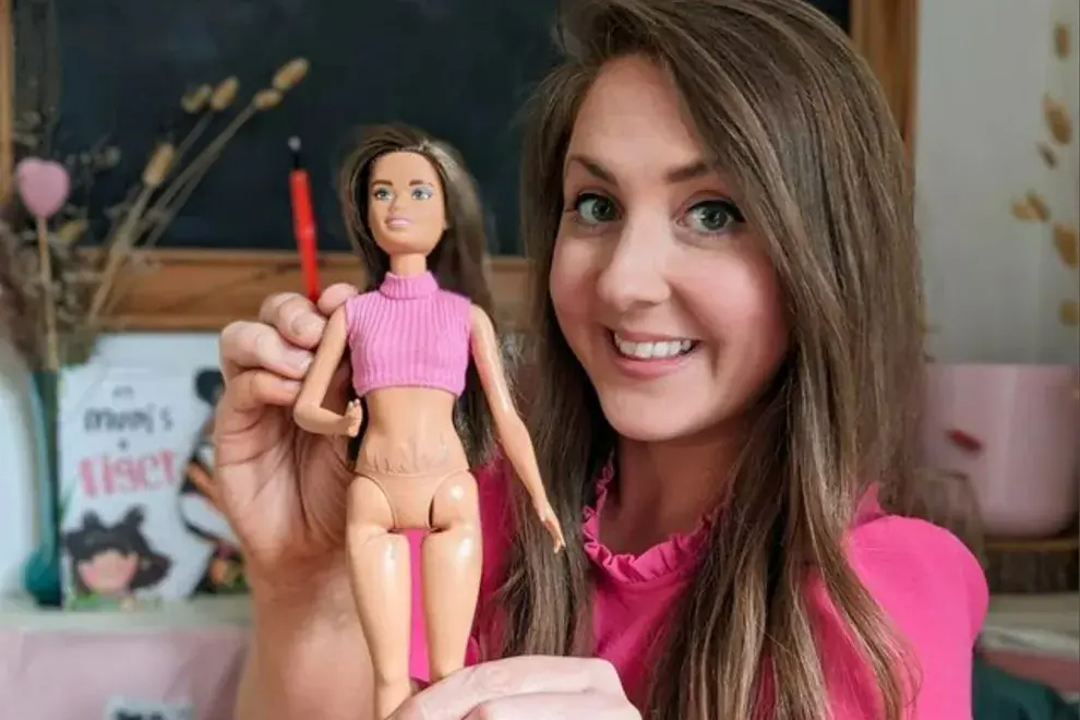 Kate Claxton con su Barbie con estrías.