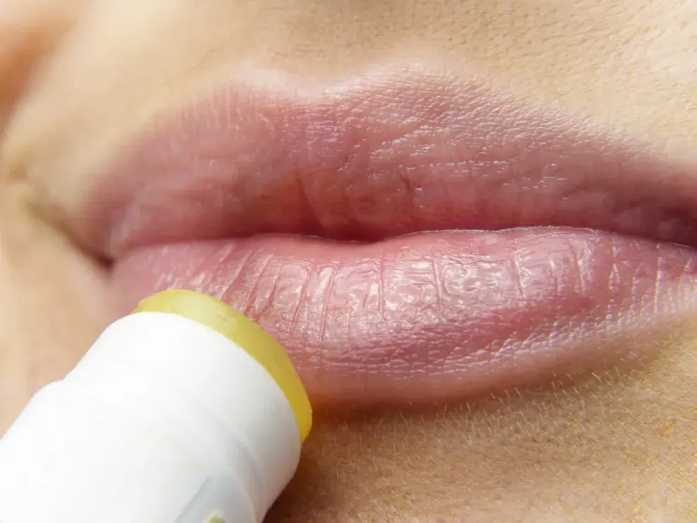 Herpes labial: ¿por qué aparecen una y otra vez y cómo protegernos?