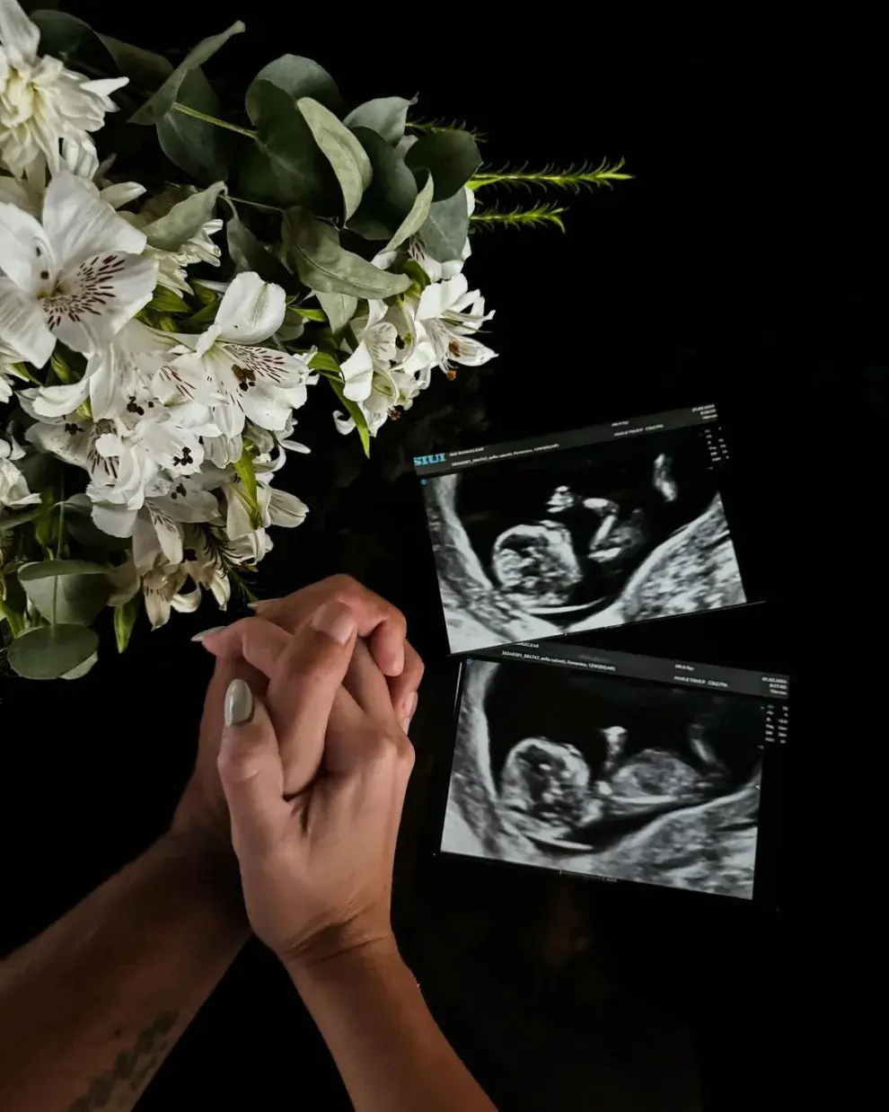 La foto con la que Kun Agüero y Sofía Calzetti anunciaron que esperaban un bebé.