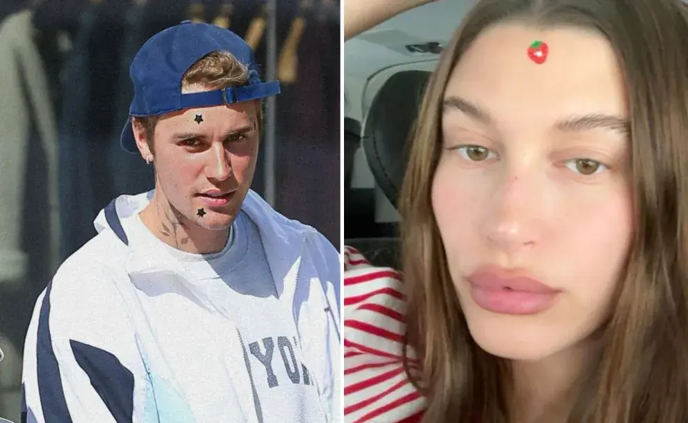 Hailey Bieber y Justin suelen usar los parches para el acné