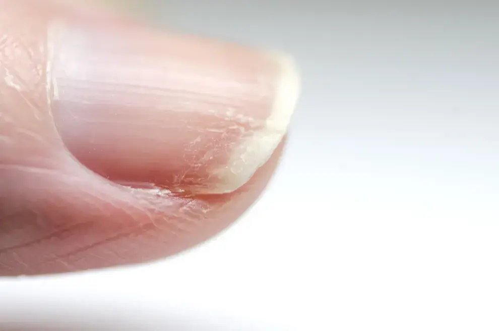 Los mejores sérums fortalecedores de uñas para tenerlas naturales sin roturas ni grietas