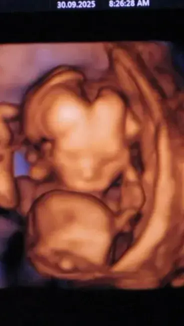 La ecografía del primer hijo que esperan Oriana Sabatini y Paulo Dybala.