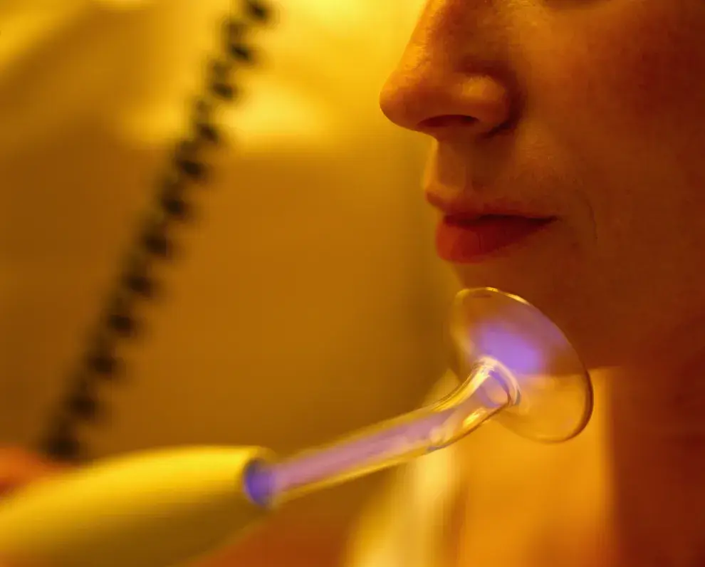 Principales beneficios y ventajas de los tratamientos de alta frecuencia facial.