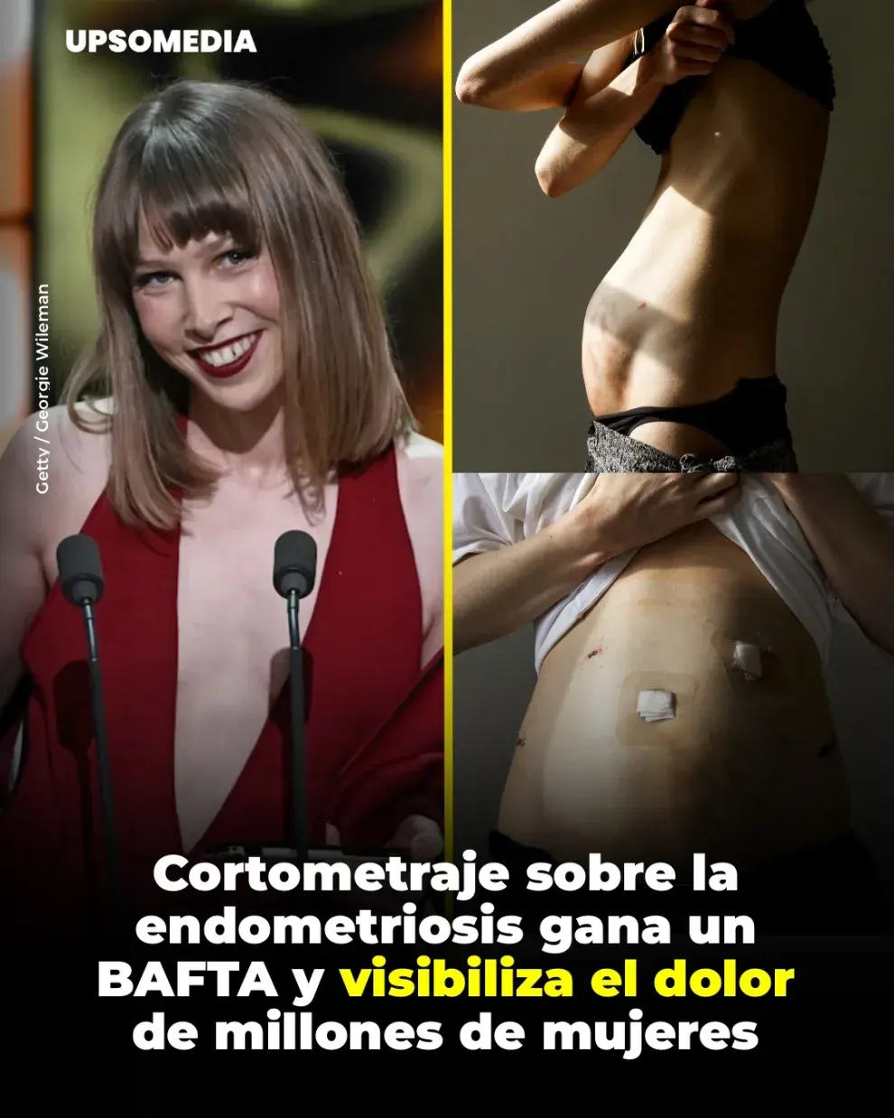 Corto premiado sobre endometriosis