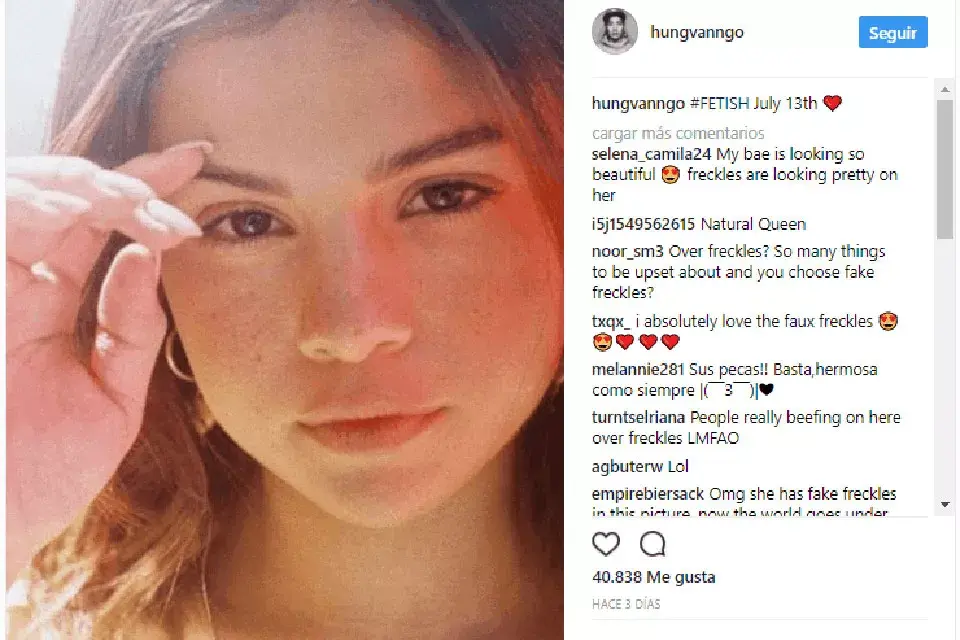 Las pecas de Selena Gomez dividieron las aguas entre sus fans, algunas las amaron otros se pronunciaron en contra por considerar que no son naturales