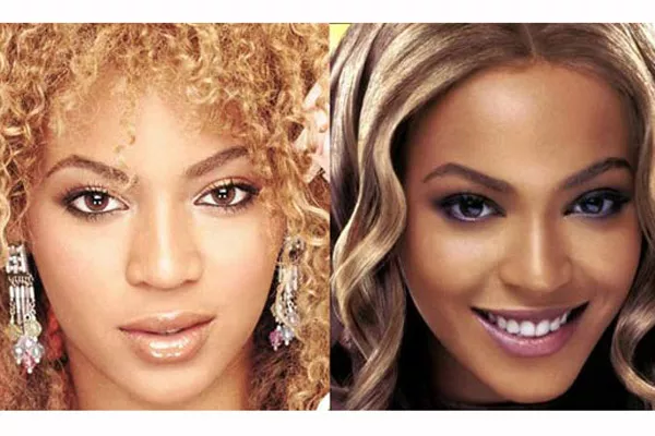 Afinarse la nariz, una tendencia entre los famosos, como en el caso de Beyonce