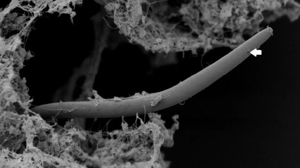 Este es un gusano nematodo de la familia Monhystrella parvella