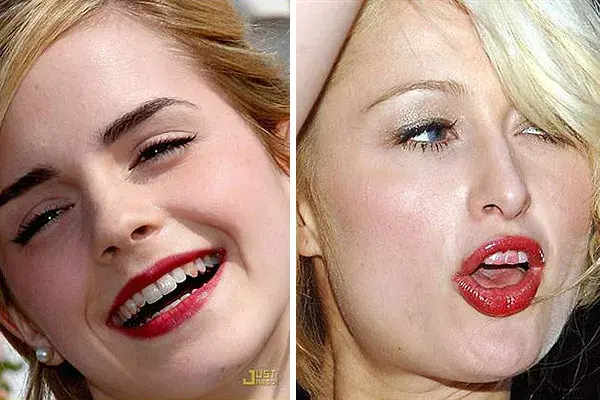 Dientes manchados: uno de los peores errores de maquillaje, como se ve en el rostro de Emma Watson y en el de Paris Hilton