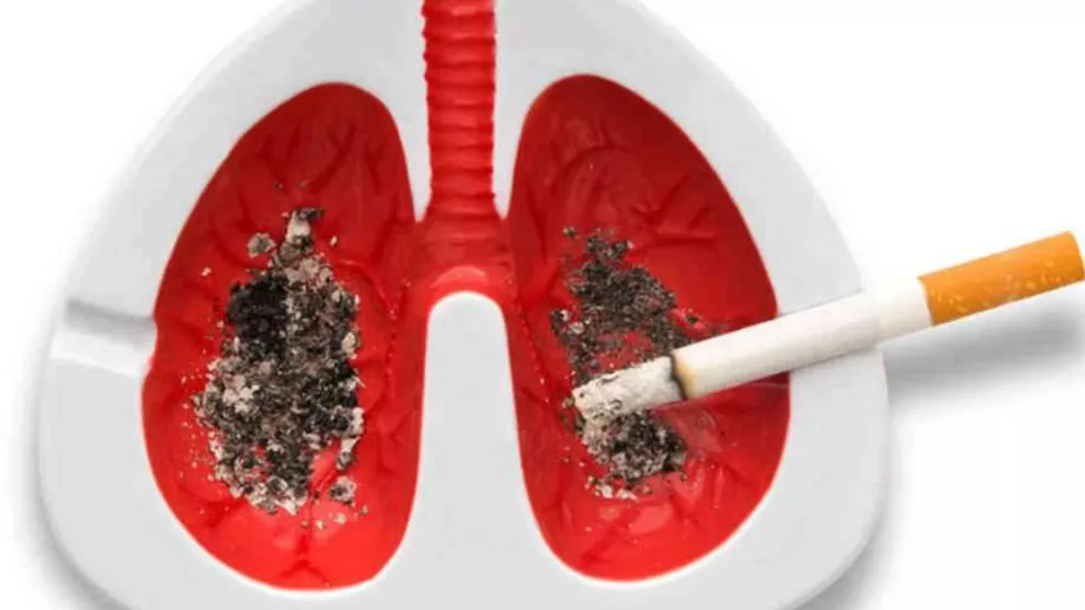 El cigarrillo es causante del cáncer de pulmón y de numerosas enfermedades respiratorias crónicas