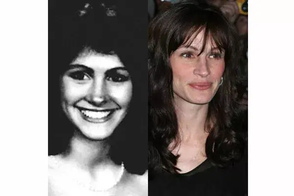 Julia Roberts, otra celebrity que afinó las facciones de la cara