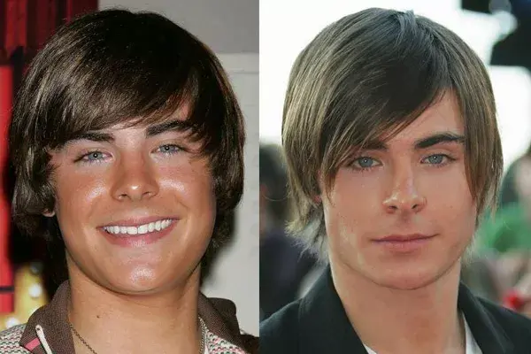 Zac Efron, con nariz más respingada
