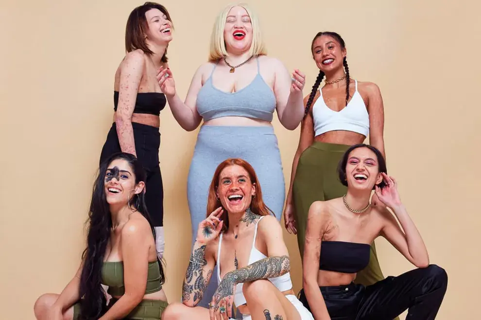 Cada vez hay más iniciativas y compromiso de las marcas mainstream para derribar estereotipos. lo celebramos. En esta foto, la campaña #inyourownskin de la marca Missguided.