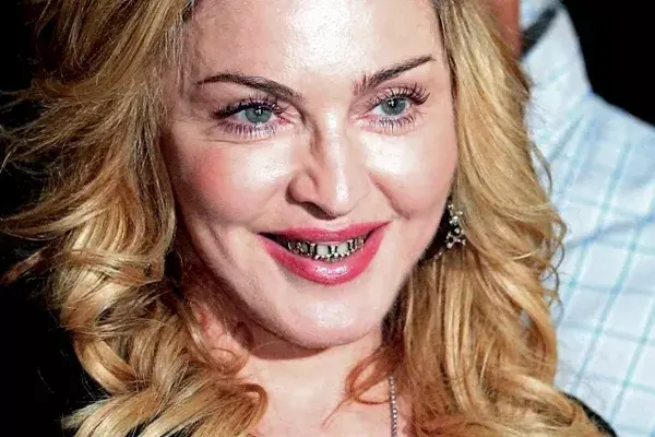 Madonna vistió sus dientes con una funda de oro y brillantes, en el mundo del Hip Hop es sinónimo de poder y riqueza
