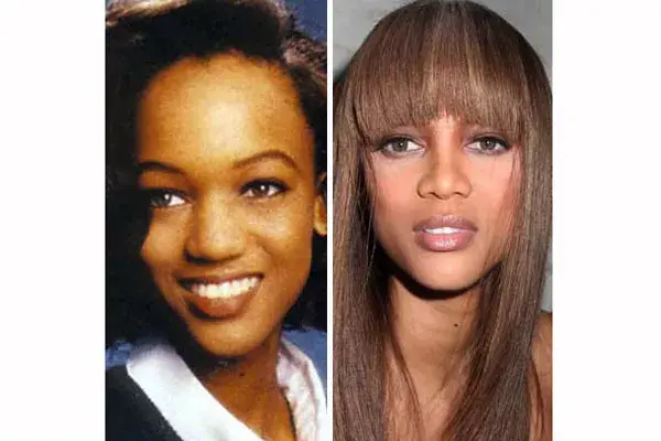 Una nariz mucho más fina para Tyra Banks