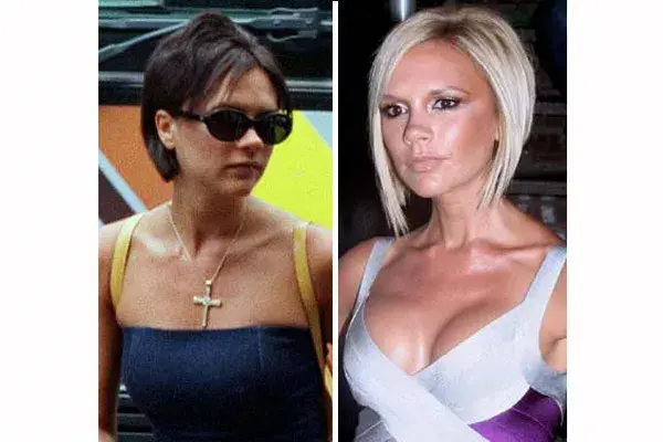 Cirugía de nariz, una de las tantas a las que se sometó Victoria Beckham
