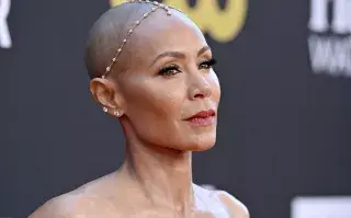 Jada Pinkett Smith fue una de las primeras celebrities en hablar sobre alopecia.