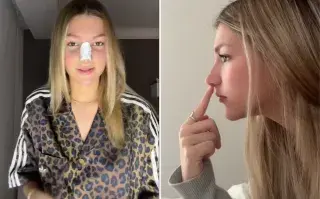 Jazmín Oltra se operó la nariz a los 16 años y dijo que se sacó un trauma