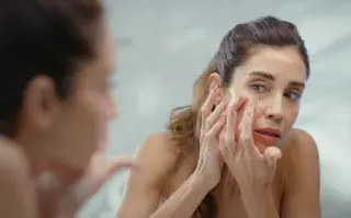 Acné en personas adultas: por qué aparece y cómo aliviarlo.